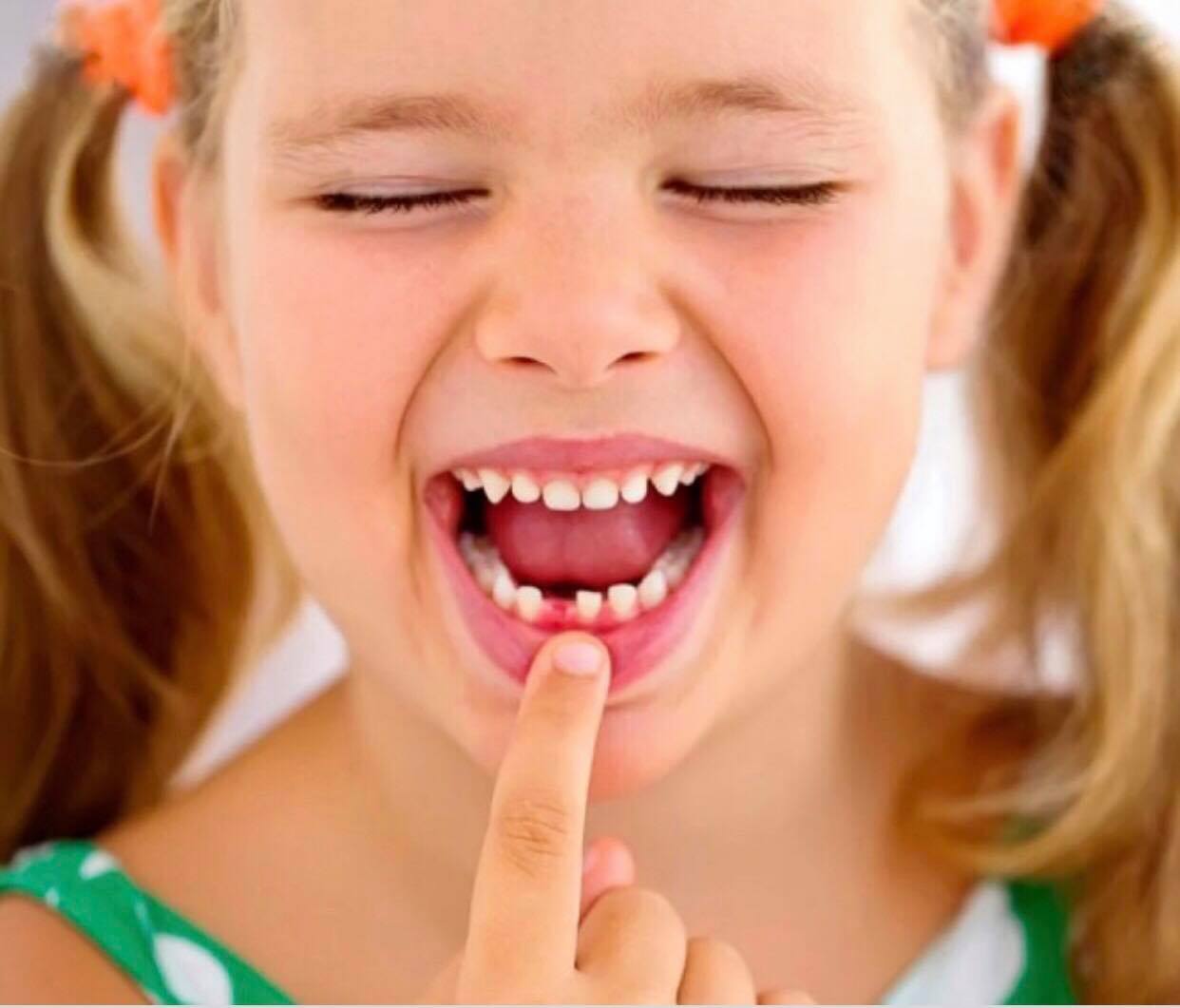 Чи можна вилікувати дуже погані зуби?